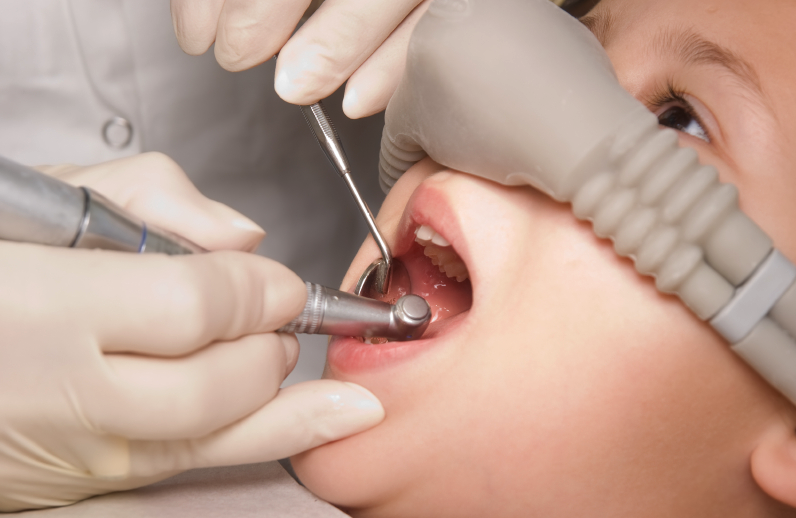 A small boy under Nitrous Oxide sedation at the dentist