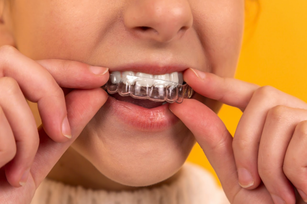 A girl putting in her Invisalign in Corona, CA