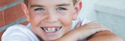 Young boy smiling with traditional braces, Corona CA