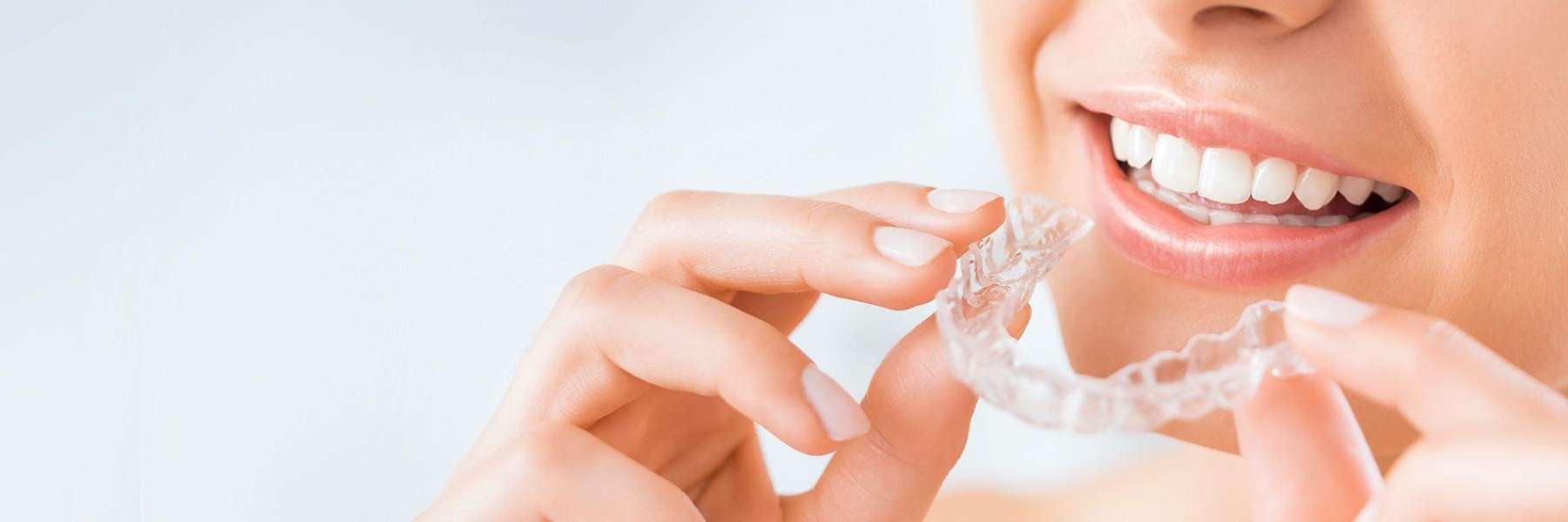 clear aligners for kids