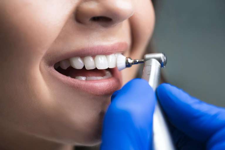 A dentist cleaning a patient's teeth