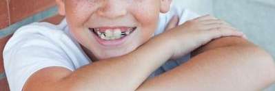 A smiling child with braces